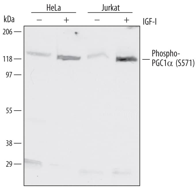 Detection of Human Phospho-PGC1a (S571) antibody by Western Blot.