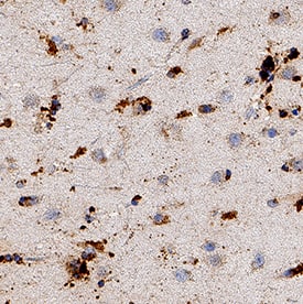 PGD2 Synthase/PTGDS antibody in Human Brain by Immunohistochemistry (IHC-P).