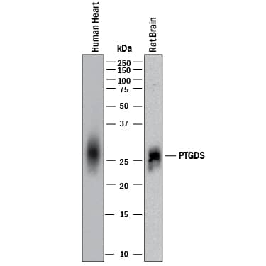 Detection of Human and Rat PGD2 Synthase/PTGDS antibody by Western Blot.