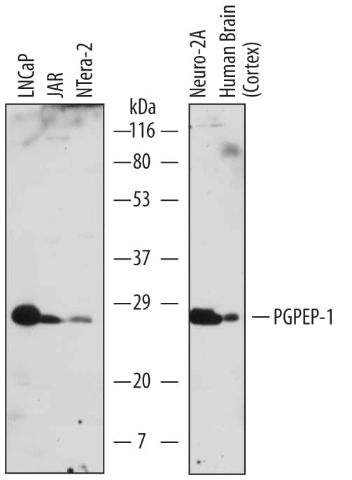 Detection of Human and Mouse PGPEP-1 antibody by Western Blot.