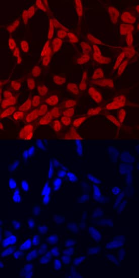 PHOX2B antibody in IMR-32 Human Cell Line by Immunocytochemistry (ICC).