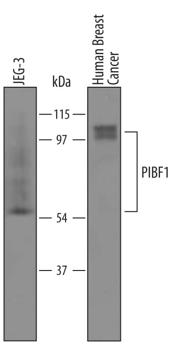 Detection of Human PIBF1 antibody by Western Blot.