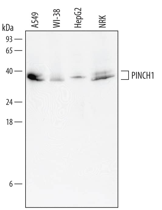 Detection of Human and Rat PINCH1 antibody by Western Blot.