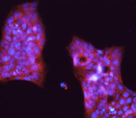 PIWIL1/HIWI antibody in NCI-N87 Human Cell Line by Immunocytochemistry (ICC).