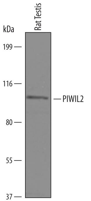 Detection of Rat PIWIL2 antibody by Western Blot.