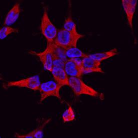 PI 3-Kinase C2 beta antibody in HEK293 Human Cell Line by Immunocytochemistry (ICC).