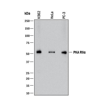 Detection of Human PKA RIIa antibody by Western Blot.