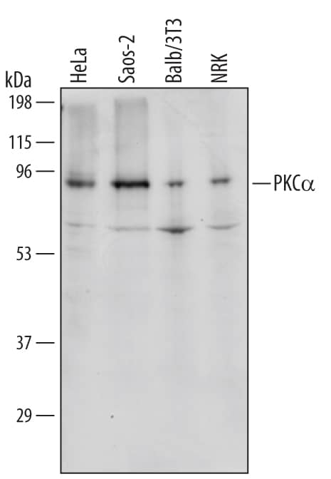 Detection of Human/Mouse/Rat PKCa antibody by Western Blot.