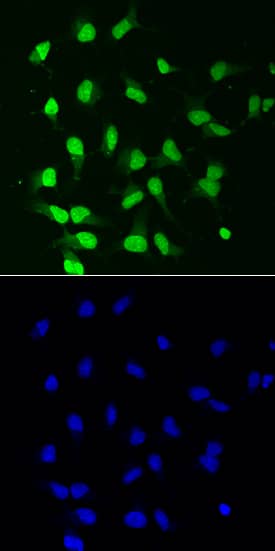 PKC beta1 antibody in Rat Cortical Stem Cells by Immunocytochemistry (ICC).