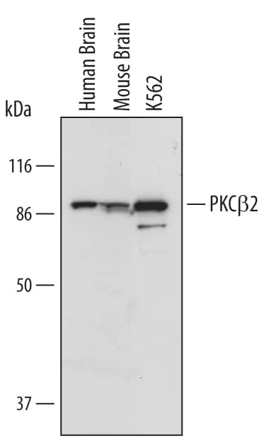 Detection of Human PKC beta2 antibody by Western Blot.