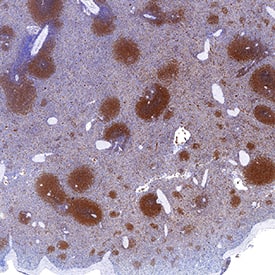 PKC beta2 antibody in Human Spleen by Immunohistochemistry (IHC-P).