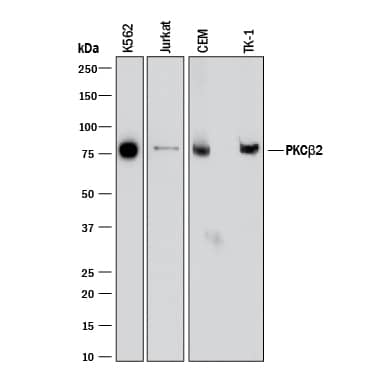 Detection of Human and Mouse PKC beta2 antibody by Western Blot.