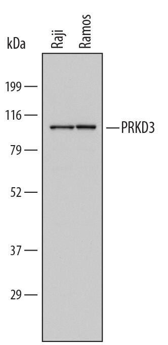 Detection of Human PRKD3/nPKC? antibody by Western Blot.