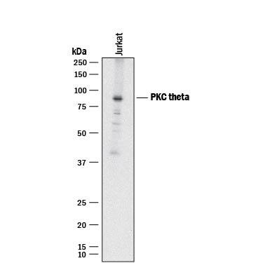 Detection of Human PKC? antibody by Western Blot.