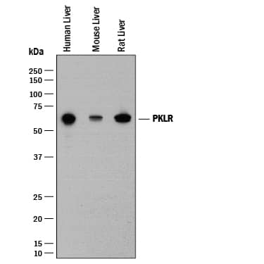 Detection of Human, Mouse, and Rat PKLR antibody by Western Blot.