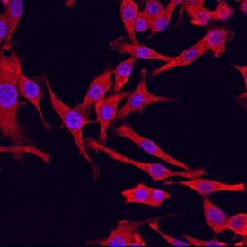 PKM2 antibody in RAW 264 by Immunocytochemistry (ICC).7 Mouse Cell Line by Immunocytochemistry (ICC).