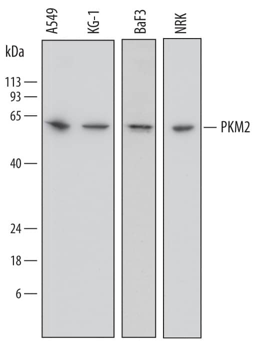 Detection of Human, Mouse, and Rat PKM2 antibody by Western Blot.