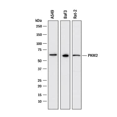 Detection of Human, Mouse, and Rat PKM2 antibody by Western Blot.