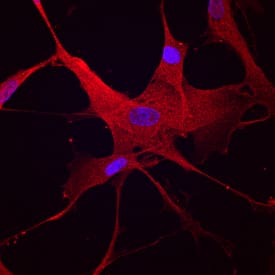 PKM2 antibody in WI-38 Human Cell Line by Immunocytochemistry (ICC).