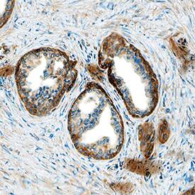 PKM2 antibody in Human Prostate by Immunohistochemistry (IHC-P).