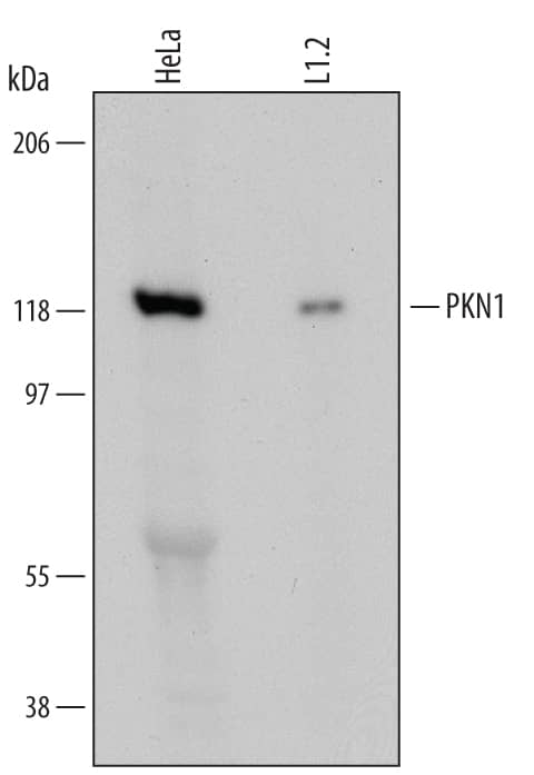 Detection of Human and Mouse PKN1 antibody by Western Blot.