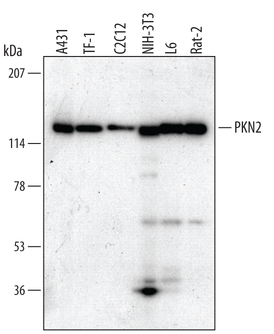 Detection of Human/Mouse/Rat PKN2 antibody by Western Blot.