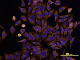PKR antibody in HeLa Human Cell Line by Immunocytochemistry (ICC).