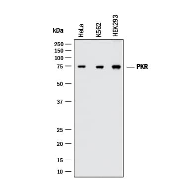 Detection of Human PKR antibody by Western Blot.