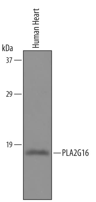 Detection of Human PLA2G16 antibody by Western Blot.