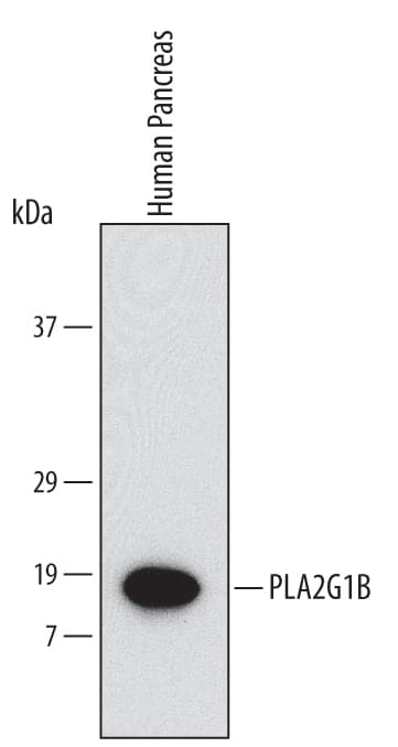 Detection of Human PLA2G1B antibody by Western Blot.