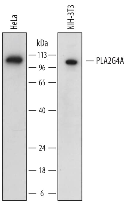 Detection of Human and Mouse PLA2G4A antibody by Western Blot.