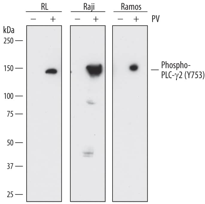 Detection of Human Phospho-PLC-?2 (Y753) antibody by Western Blot.