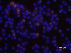 PLC-?2 antibody in Human PBMCs by Immunocytochemistry (ICC).