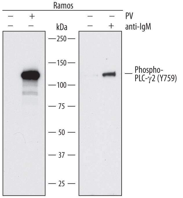 Detection of Human Phospho-PLC-?2 (Y759) antibody by Western Blot.