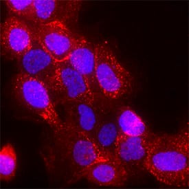 Phospho-PLC-?1 (Y783) antibody in A431 Human Cell Line by Immunocytochemistry (ICC).