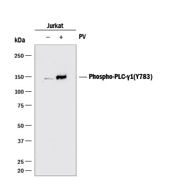 Detection of Human Phospho-PLC-?1 (Y783) antibody by Western Blot.