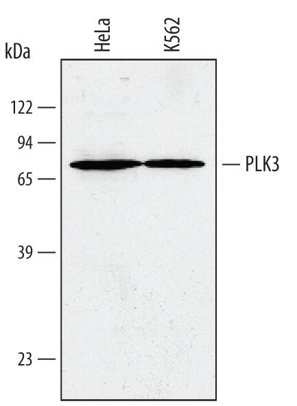 Detection of Human PLK3 antibody by Western Blot.