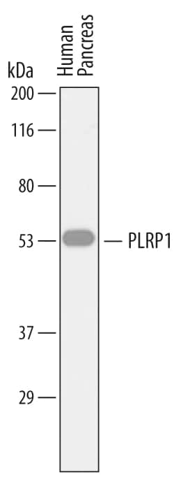 Detection of Human PLRP1 antibody by Western Blot.