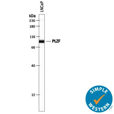 Detection of Human PLZF antibody by Simple WesternTM.