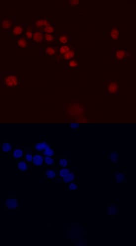 PLZF antibody in HL-60 Human Cell Line by Immunocytochemistry (ICC).