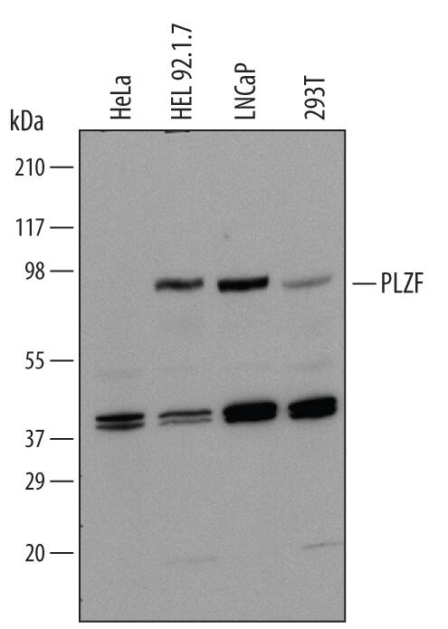 Detection of Human PLZF antibody by Western Blot.