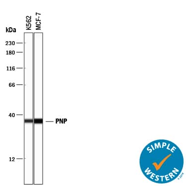 Detection of Human Purine Nucleoside Phosphorylase/PNP antibody by Simple WesternTM.