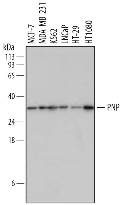 Detection of Human Purine Nucleoside Phosphorylase/ PNP antibody by Western Blot.