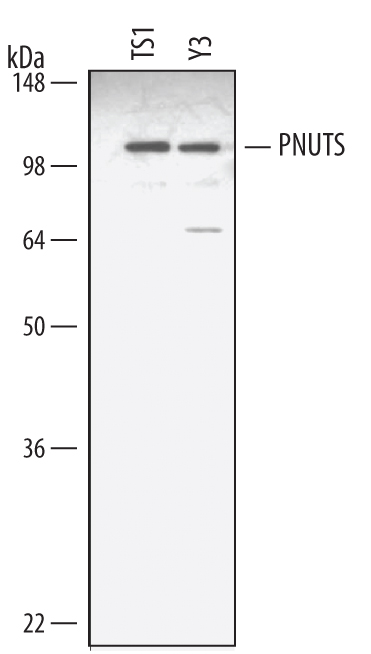 Detection of Mouse and Rat PNUTS antibody by Western Blot.