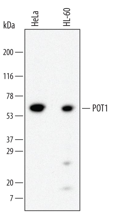 Detection of Human POT1 antibody by Western Blot.