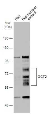 Western Blot: OCT2 Antibody [NBP3-13282]