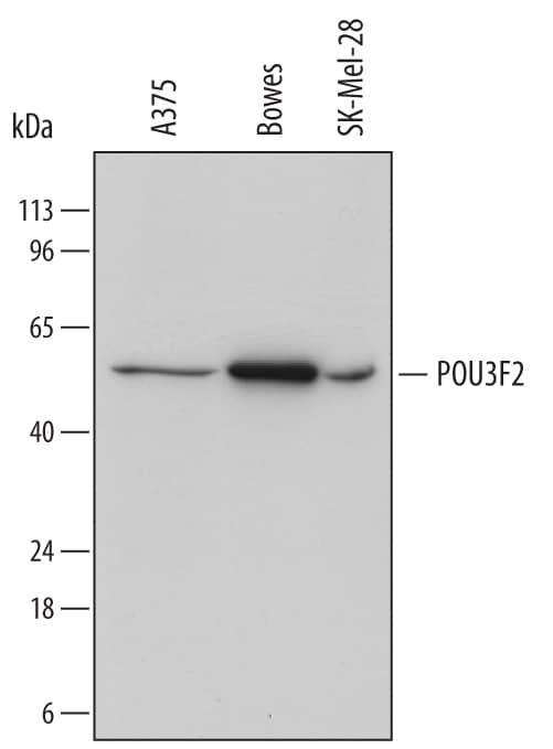 Detection of Human POU3F2 antibody by Western Blot.