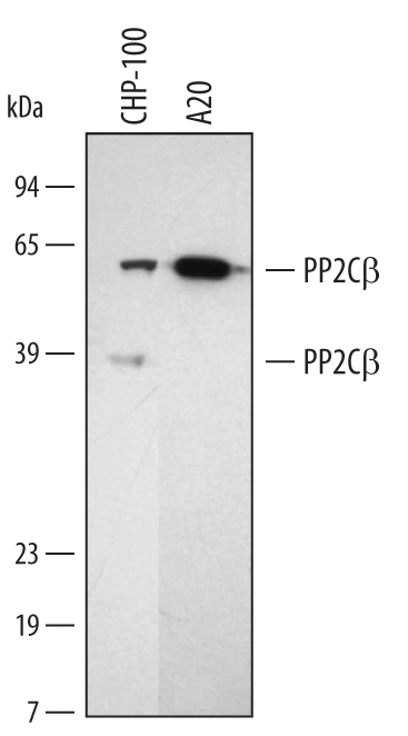 Detection of Human/Mouse/Rat PP2C beta/PPM1B antibody by Western Blot.