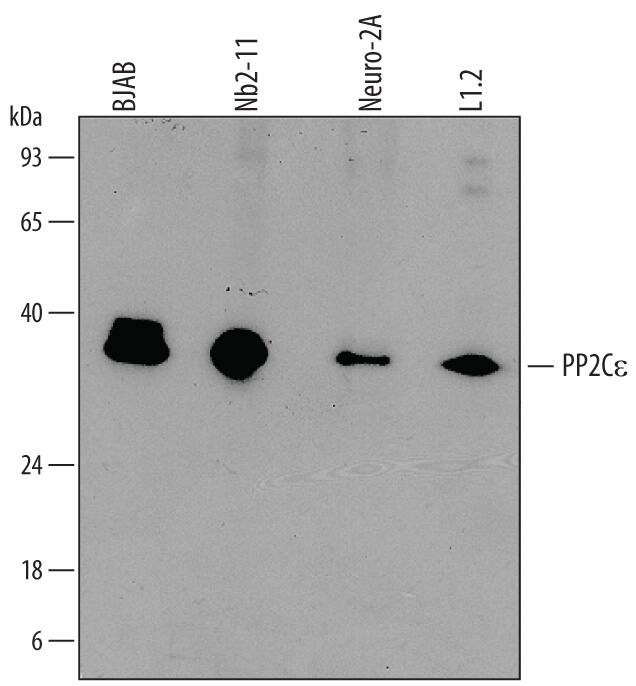 Detection of Human, Mouse, and Rat PP2C e/PPM1L antibody by Western Blot.