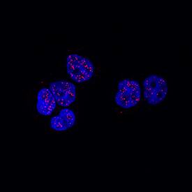 PPARa/NR1C1 antibody in HT-29 Human Cell Line by Immunocytochemistry (ICC).